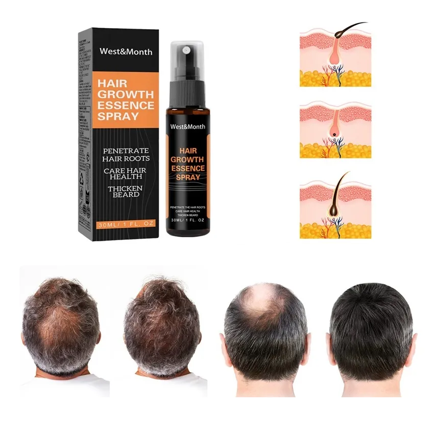 Tónico Capilar de Estimulación Intensiva