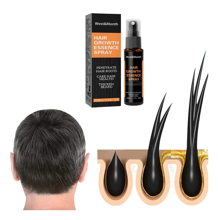 Tónico Capilar de Estimulación Intensiva