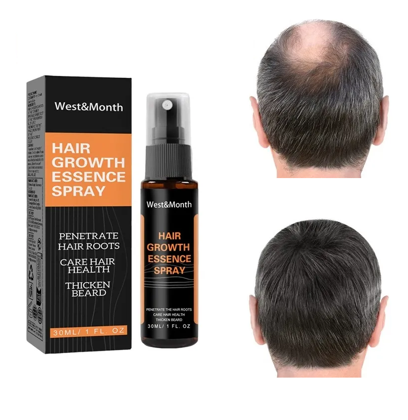 Tónico Capilar de Estimulación Intensiva